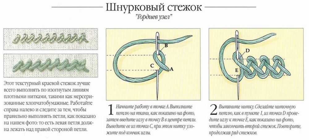 Как выглядит шов эпизиотомии фото